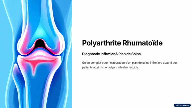 polyarthrite