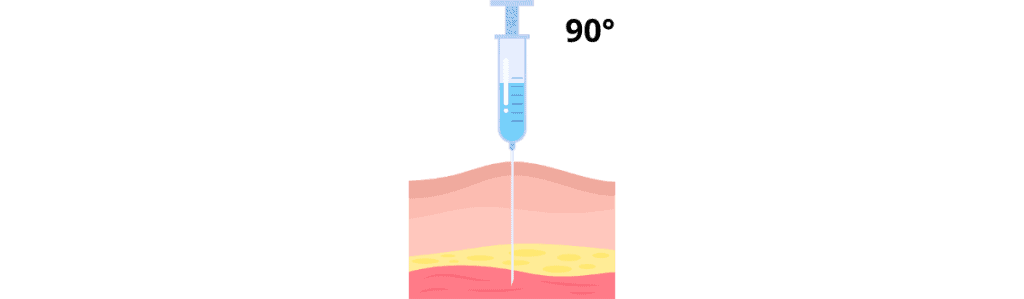 Injections sous-cutanée et Intramusculaire injection intramusculaire 90°