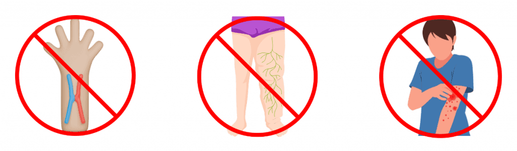 Pose d’une voie veineuse périphérique (VVP) interdit