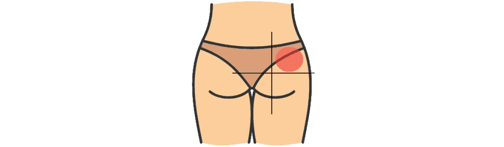 Injections sous-cutanée et Intramusculaire site intramusculaire